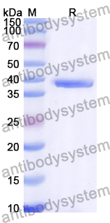 Recombinant Human KDM4B Protein, N-His
