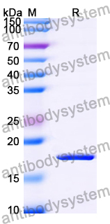 Recombinant Human TRIM37 Protein, N-His