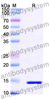 Recombinant Human SOX30 Protein, N-His