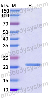 Recombinant Human DIRAS1 Protein, N-His