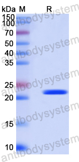 Recombinant Human REC8 Protein, N-His-SUMO & C-Strep