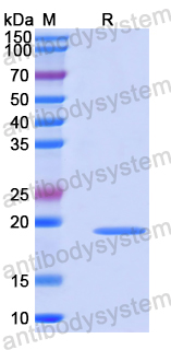 Recombinant Human NKX2-2 Protein, N-His-SUMO