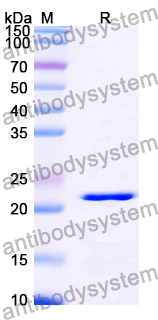 Recombinant Human ZNF202 Protein, N-His