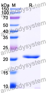 Recombinant Human DUSP14 Protein, N-His