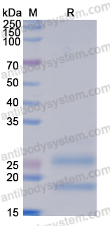 Recombinant Human NDUFB8 Protein, N-His-SUMO & C-Strep