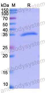 Recombinant Human KAT7 Protein, N-His