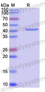 Recombinant Human CCNDBP1 Protein, N-His