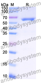 Recombinant Human FKBP9 Protein, N-His