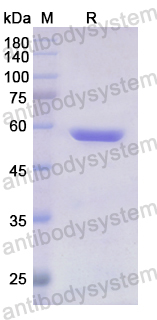 Recombinant Human FARS2 Protein, N-His