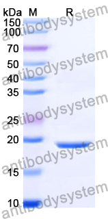 Recombinant Human SLU7 Protein, N-His