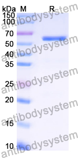 Recombinant Human PGM3 Protein, N-His