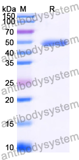 Recombinant Human GCNT3 Protein, N-His
