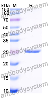 Recombinant Human SLC2A10 Protein, N-His-KSI