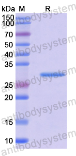 Recombinant Human TDP2 Protein, N-His