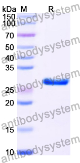 Recombinant Human ETHE1 Protein, N-His
