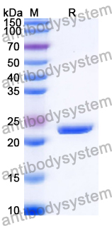 Recombinant Human POLR1A Protein, N-His