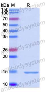 Recombinant Human CEP43 Protein, N-His