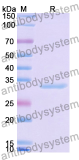 Recombinant Human APBB3 Protein, N-His