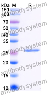 Recombinant Human ESRRB Protein, N-His