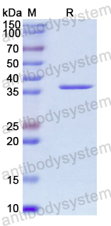 Recombinant Human GGPS1 Protein, N-His