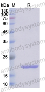 Recombinant Human IL33 Protein, N-His