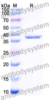 Recombinant Human LSM8 Protein, N-GST & C-His