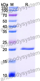 Recombinant Human TTC4 Protein, N-His