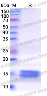 Recombinant Human CAVIN2 Protein, N-His