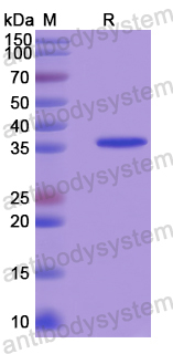 Recombinant Human MLYCD Protein, N-His