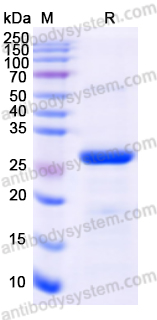 Recombinant Human DDAH2 Protein, N-His