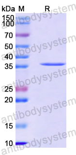 Recombinant Human FTCD Protein, N-His