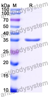 Recombinant Human SCGB1D1 Protein, N-GST & C-His