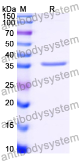 Recombinant Human SCGB1D2 Protein, N-GST & C-His