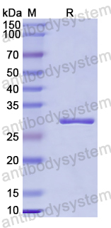 Recombinant Human MBD3 Protein, N-His