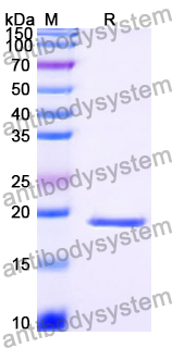 Recombinant Human NUDT3 Protein, N-His