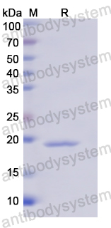 Recombinant Human IL18BP Protein, N-His