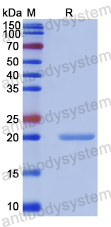 Recombinant Human NDUFB10 Protein, N-His