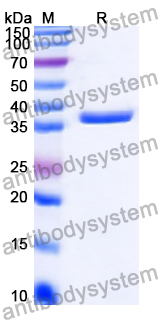 Recombinant Human MOCS2 Protein, N-GST & C-His