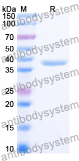 Recombinant Human CYB5A Protein, N-GST & C-His