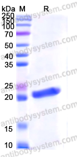 Recombinant Human SOD1 Protein, N-His