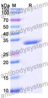 Recombinant Human MOS Protein, N-His
