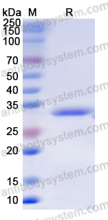 Recombinant Human PLAU Protein, N-His