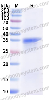 Recombinant Human OAS1 Protein, N-GST