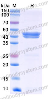 Recombinant Human SERPINA3 Protein, C-His