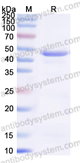 Recombinant Human FOS Protein, C-His