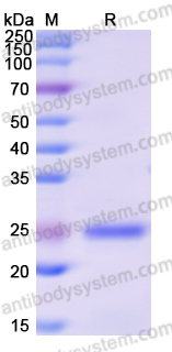 Recombinant Human NRAS Protein, N-His