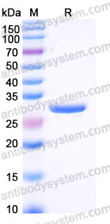 Recombinant Human pro-NGF/Beta-NGF Protein, Tag free