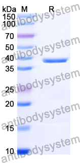 Recombinant Human POMC Protein, N-GST & C-His