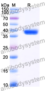 Recombinant Human PDYN Protein, N-GST & C-His