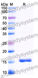 Recombinant Human LHB Protein, N-His